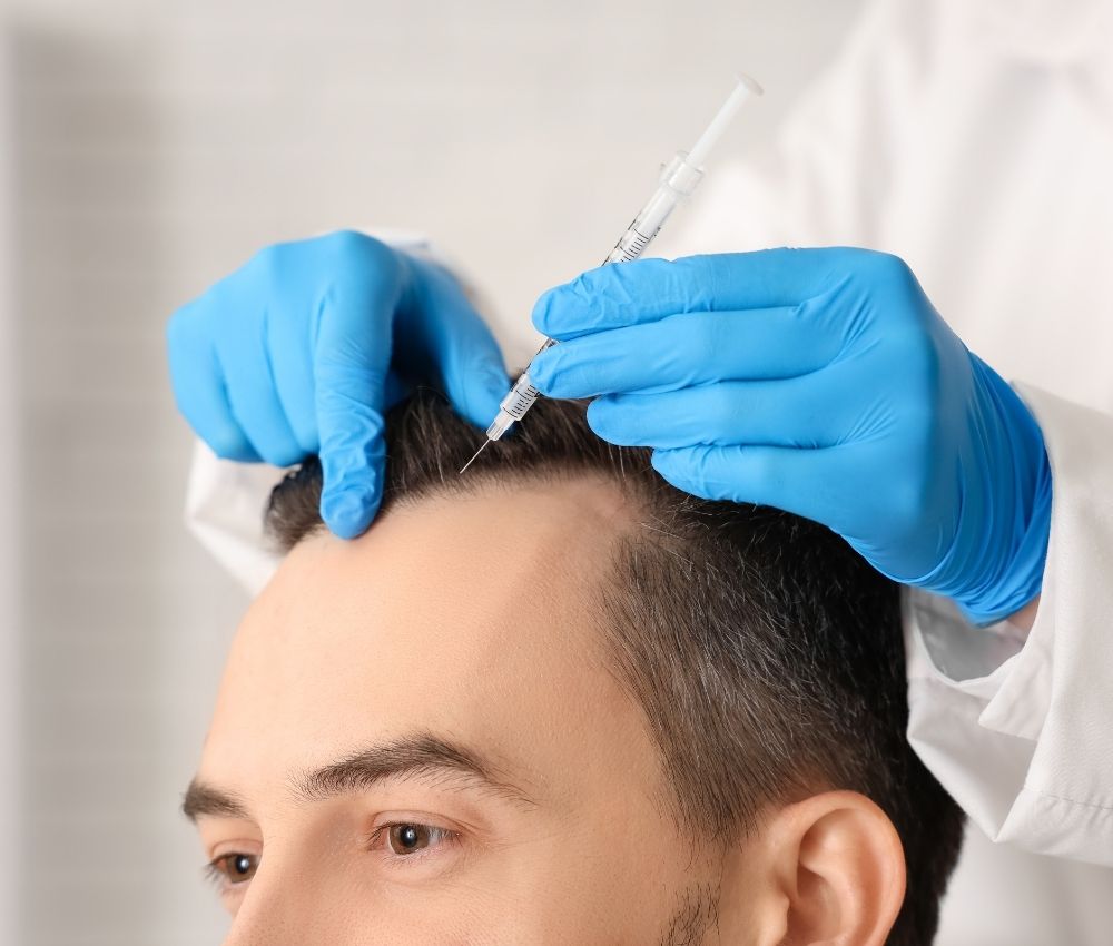 PRP Alopecia